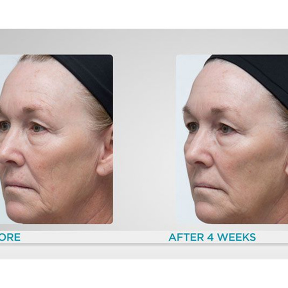 tula deep wrinkle serum